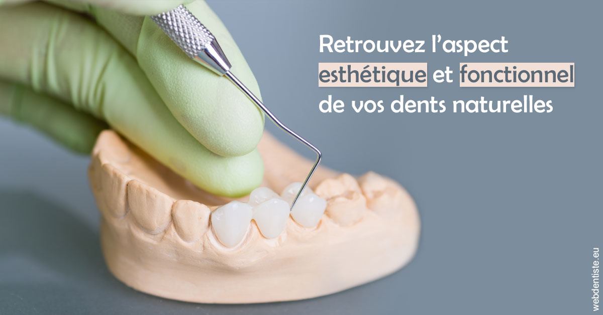 https://www.dentiste-boukobza.fr/Restaurations dentaires 1