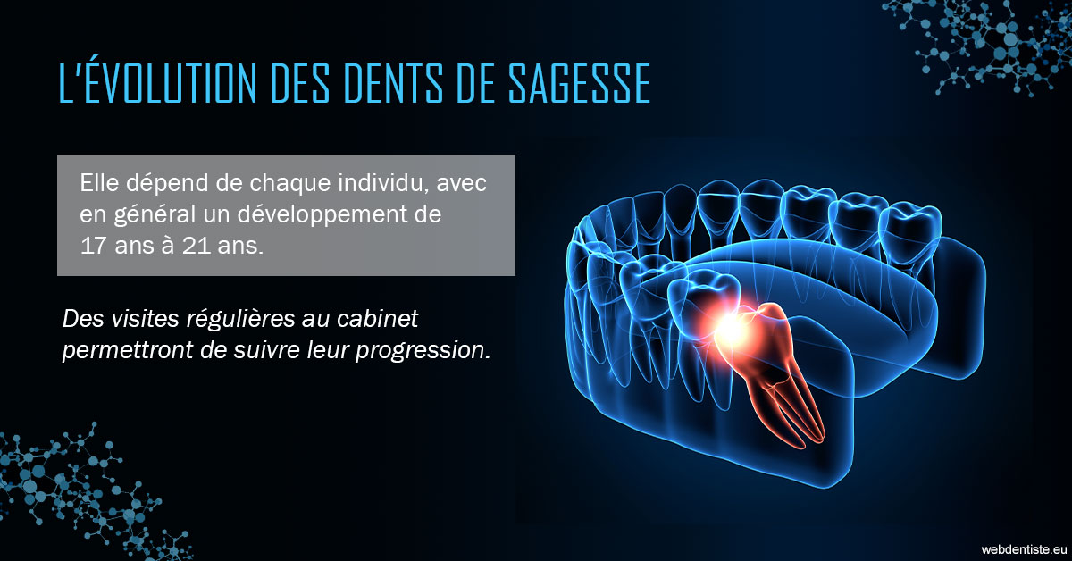 https://www.dentiste-boukobza.fr/2023 T4 - Dents de sagesse 01