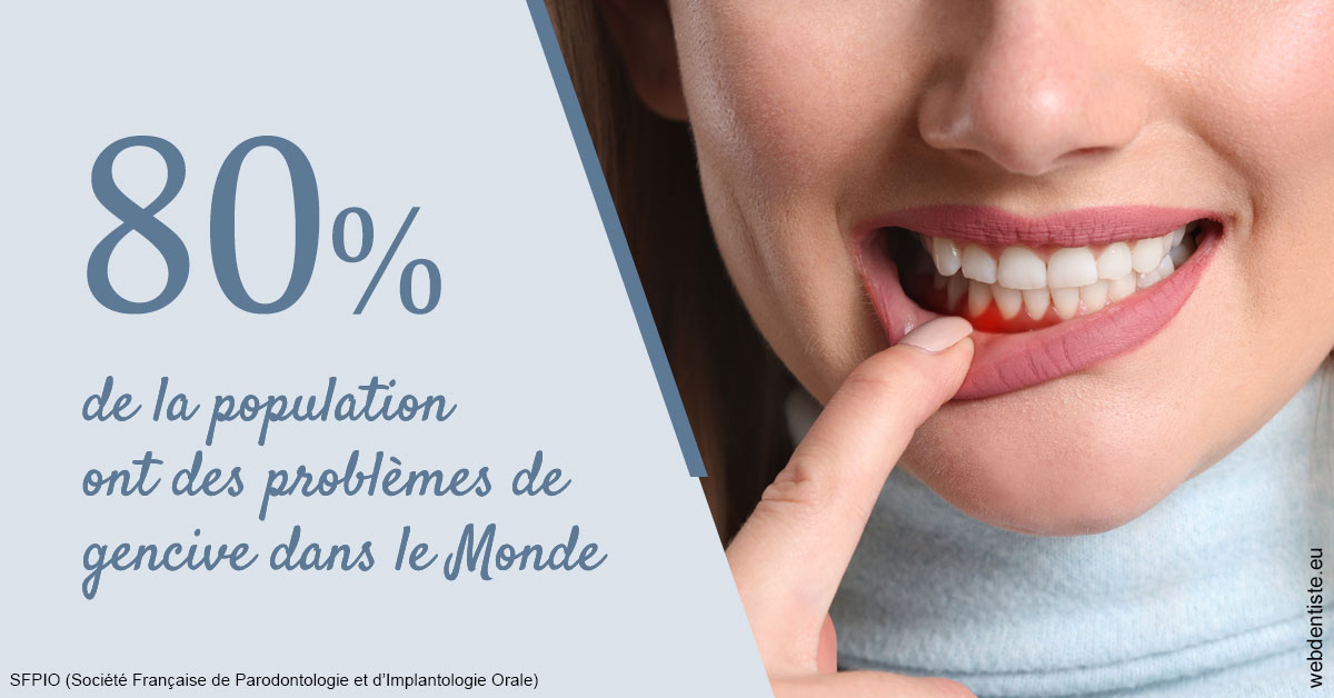 https://www.dentiste-boukobza.fr/Problèmes de gencive 2