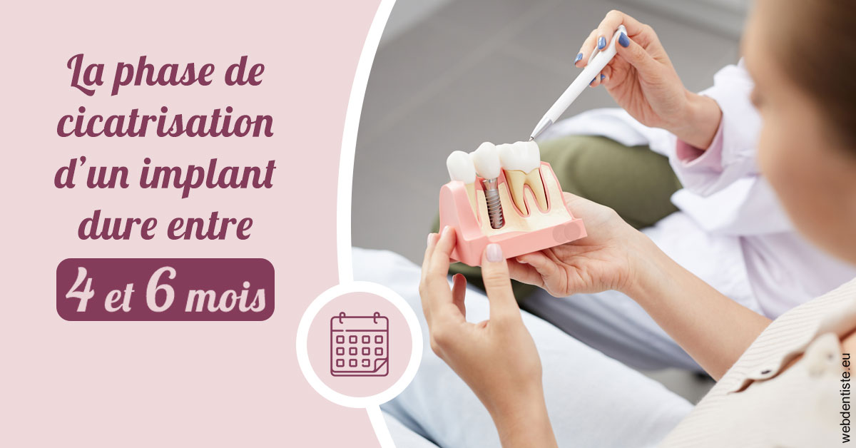 https://www.dentiste-boukobza.fr/Cicatrisation implant 2
