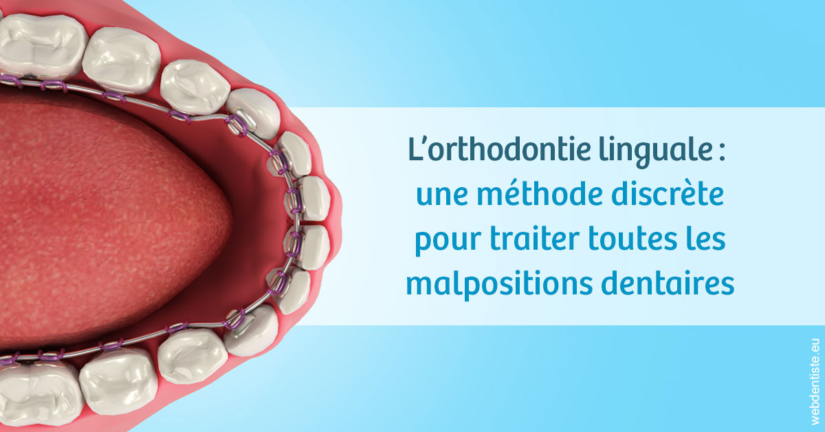 https://www.dentiste-boukobza.fr/L'orthodontie linguale 1