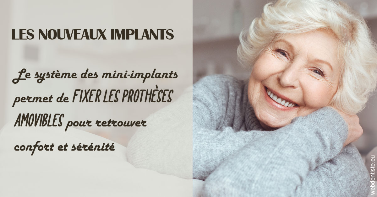 https://www.dentiste-boukobza.fr/Les nouveaux implants 1