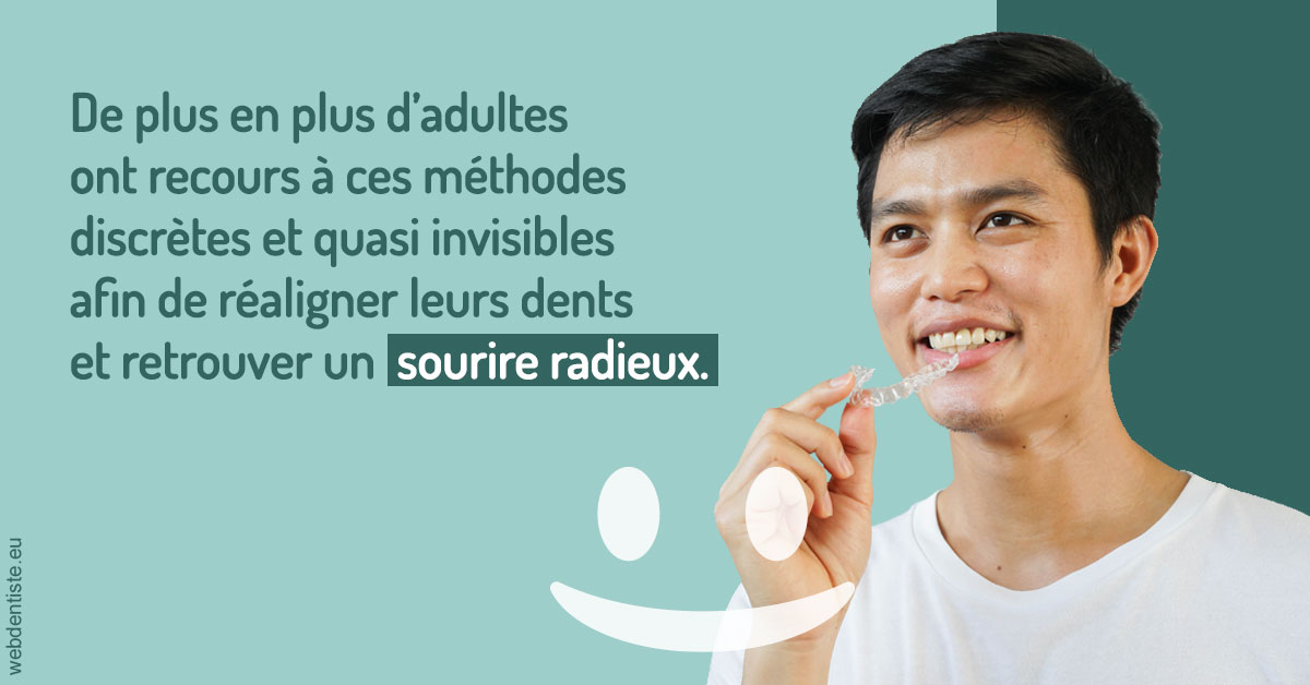 https://www.dentiste-boukobza.fr/Gouttières sourire radieux 2