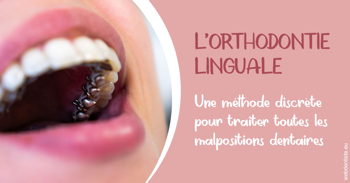 https://www.dentiste-boukobza.fr/L'orthodontie linguale 2