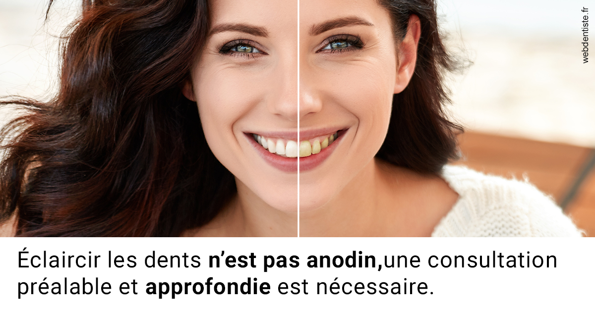 https://www.dentiste-boukobza.fr/Le blanchiment 2