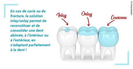 https://www.dentiste-boukobza.fr/L'INLAY ou l'ONLAY