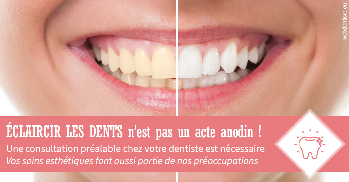https://www.dentiste-boukobza.fr/Eclaircir les dents 1