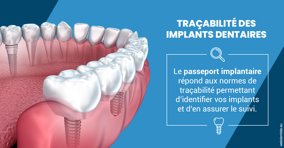 https://www.dentiste-boukobza.fr/T2 2023 - Traçabilité des implants 1