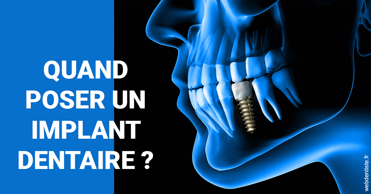 https://www.dentiste-boukobza.fr/Les implants 1
