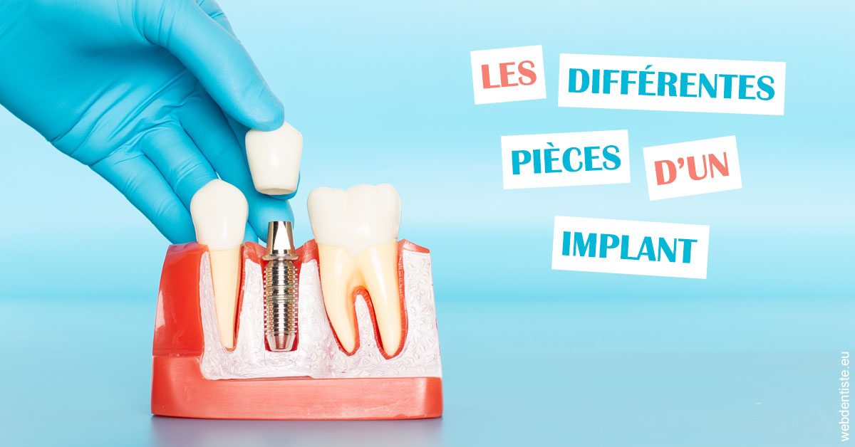 https://www.dentiste-boukobza.fr/Les différentes pièces d’un implant 2