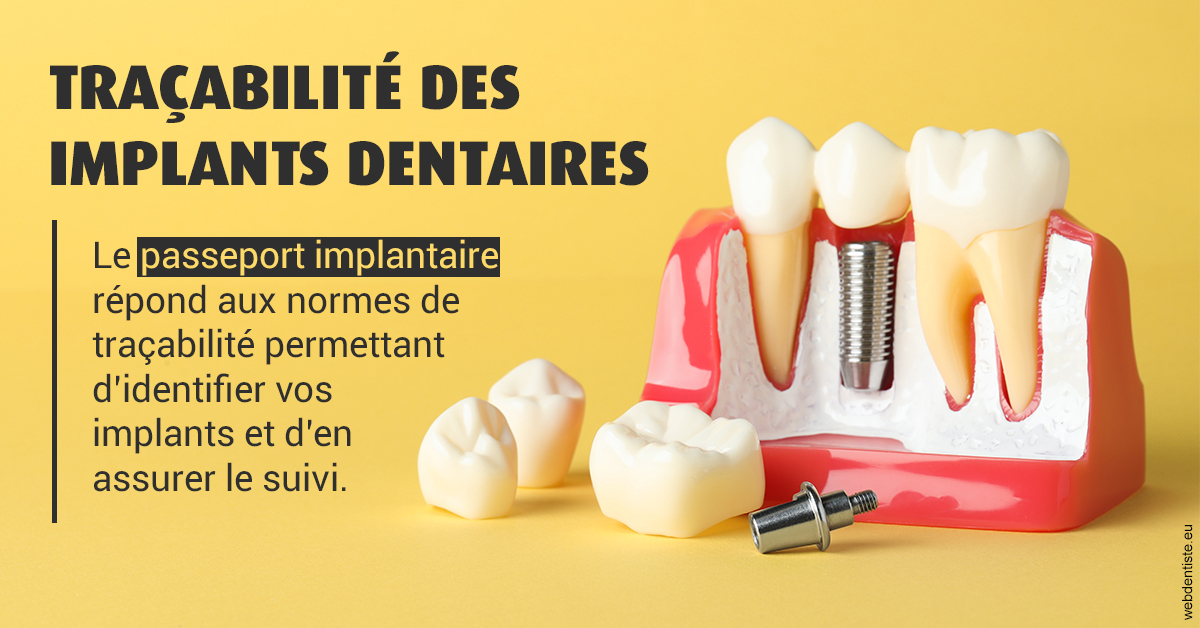 https://www.dentiste-boukobza.fr/T2 2023 - Traçabilité des implants 2