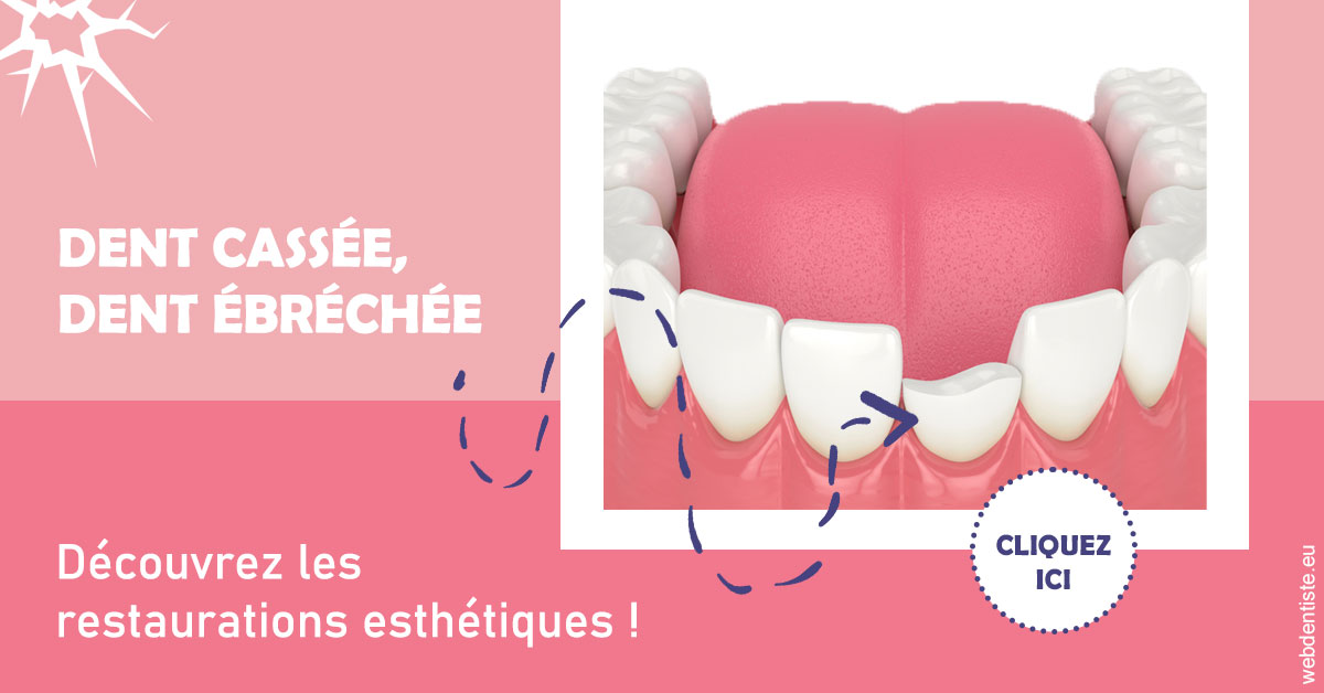 https://www.dentiste-boukobza.fr/Dent cassée ébréchée 1