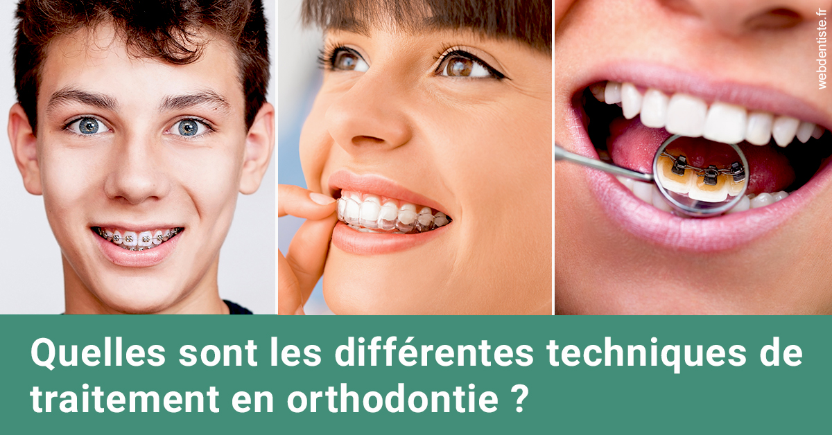 https://www.dentiste-boukobza.fr/Les différentes techniques de traitement 2