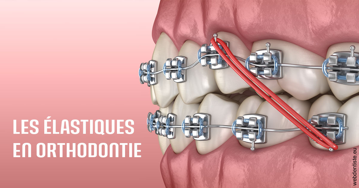 https://www.dentiste-boukobza.fr/Elastiques orthodontie 2