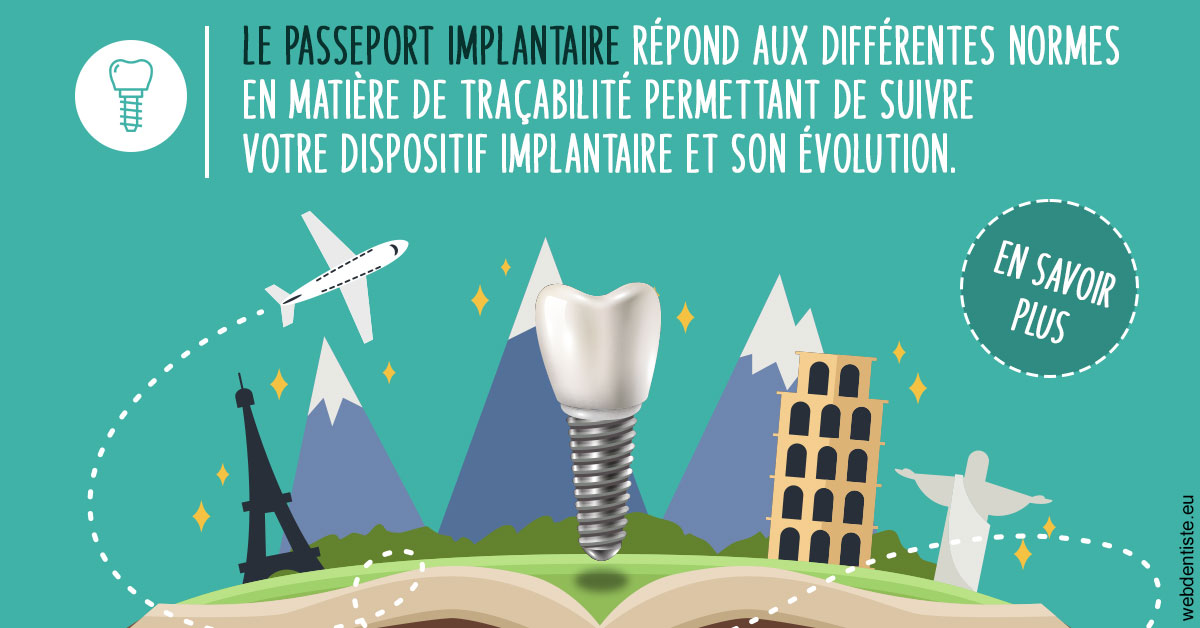 https://www.dentiste-boukobza.fr/Le passeport implantaire