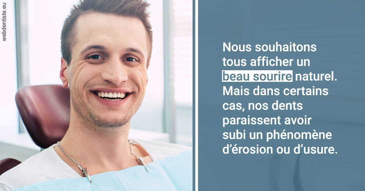 https://www.dentiste-boukobza.fr/Érosion et usure dentaire