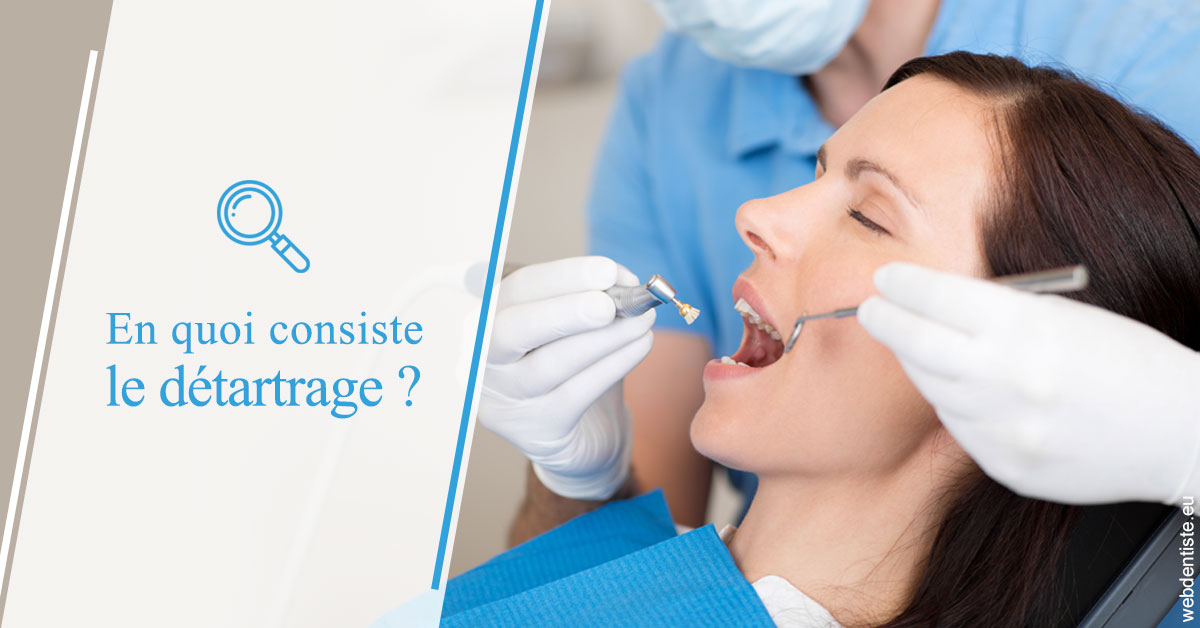 https://www.dentiste-boukobza.fr/En quoi consiste le détartrage