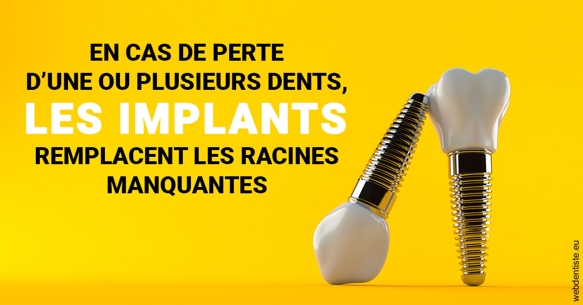 https://www.dentiste-boukobza.fr/Les implants 2