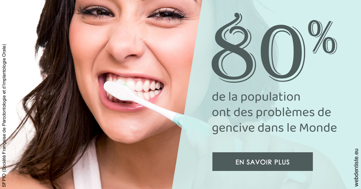 https://www.dentiste-boukobza.fr/Problèmes de gencive 1